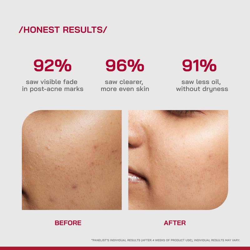Proven Honest Derma 10% Niacinamide Serum 30ml - Image 6