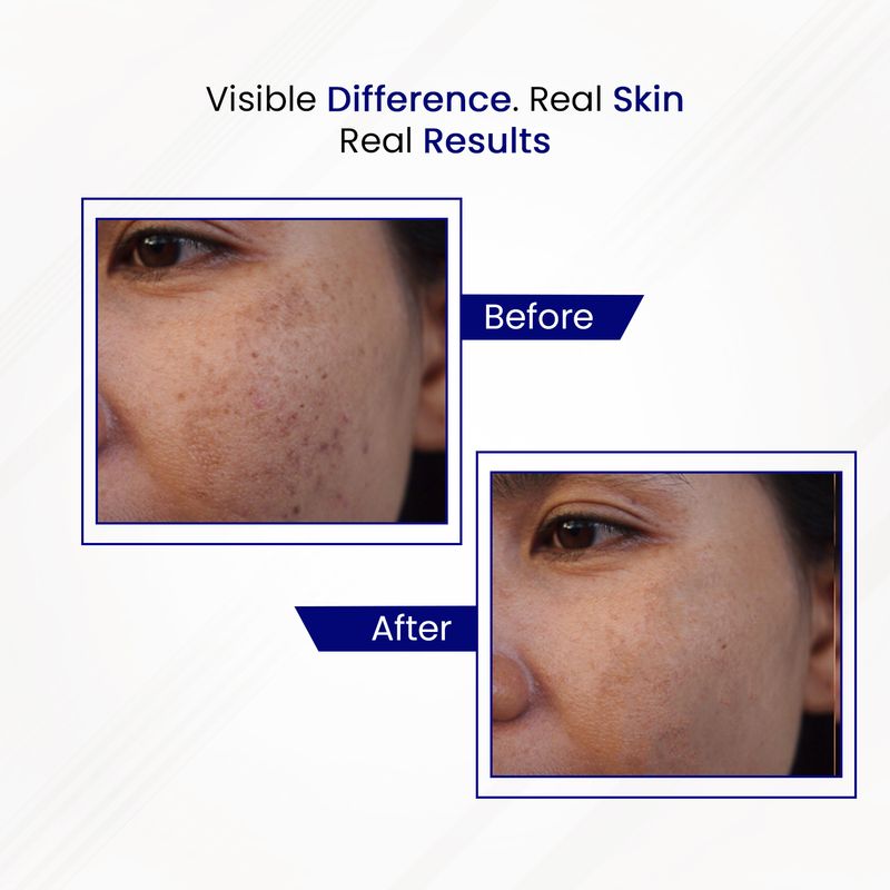 INNATE Alpha Arbutin & Zinc Face Serum - Image 4