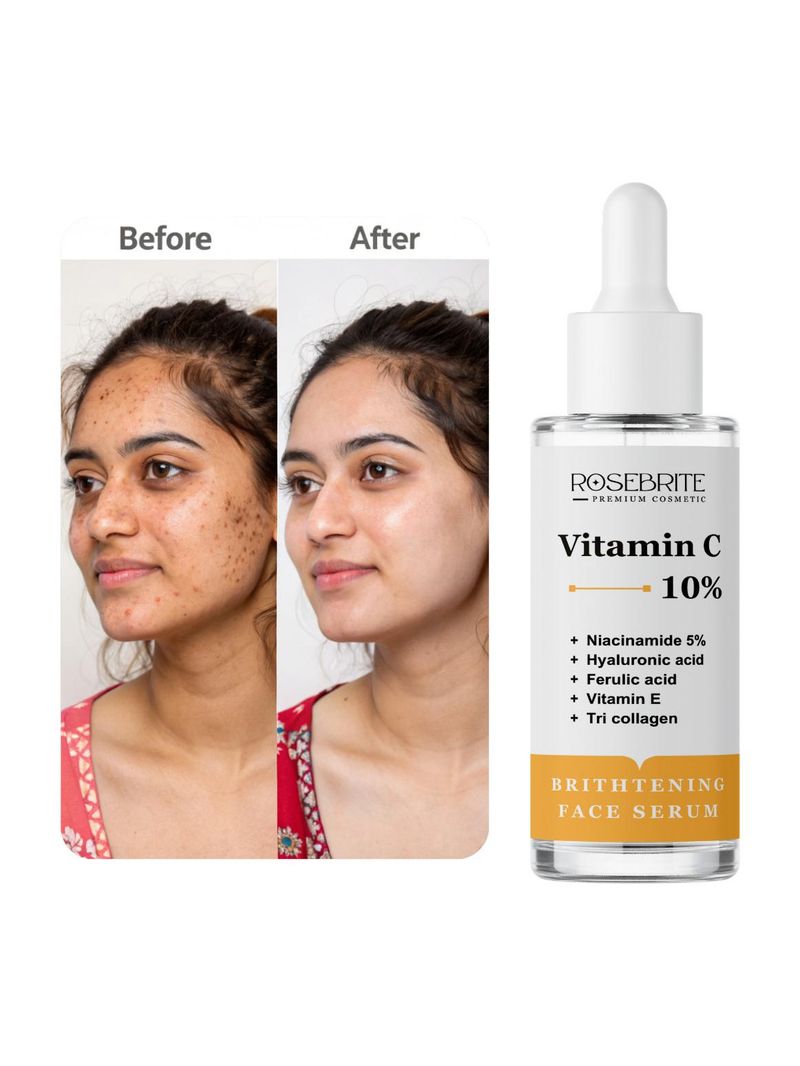 RoseBrite Vitamin C Dark Spot Corrector - Image 2