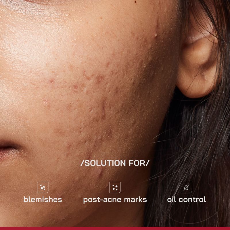 Proven Honest Derma 10% Niacinamide Serum 30ml - Image 5