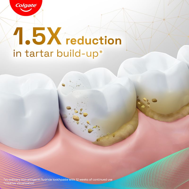 Colgate Total Anti-Tartar Anti-Germ Toothpaste 150g - Image 3