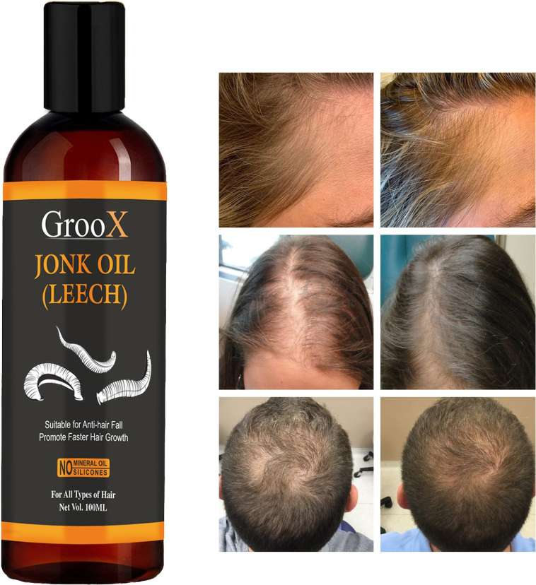 GrooX Jonk Tail - Leech Oil for Hair Growth & Control Hair Fall - Herbal Oil  Hair Oil Price in India - Buy GrooX Jonk Tail - Leech Oil for Hair Growth