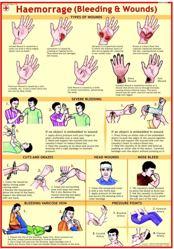 First Aid chart - Haemorrhage (Bleeding and Wounds) Photographic Paper ...