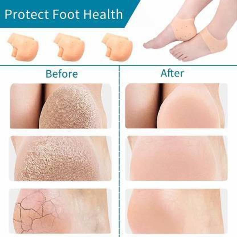 Classic deal PPF O-562 Silicon Gel Heel Socks Pad Heel Pain Relief Heel Support (Free Size, Orange)