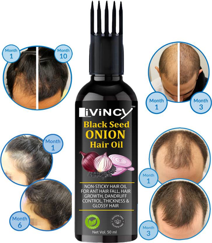 Livincy Adivasi Red Onion Hair Oil( Hair Growth, Thickness, Healthy