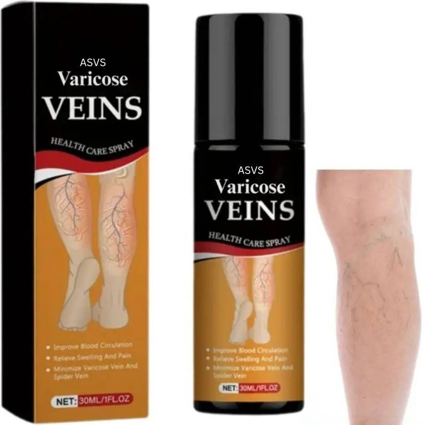 ASVS Varicose Spray for Legs for Blood Circulation Spray Spray