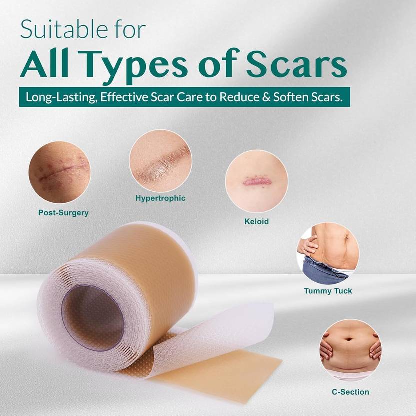 CROWNS Scar Care Silicone Sheet 4cm x 150cm Gauze Medical Dressing