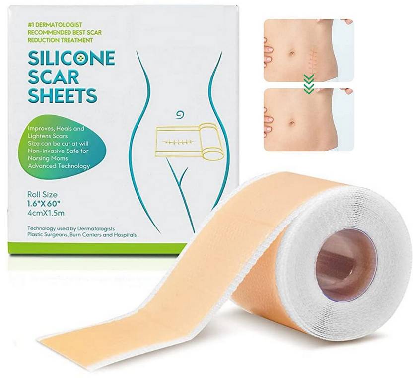 NIRMATSARAY Scaraway Silicone Scar Sheets Flesh Color Silicone Scar