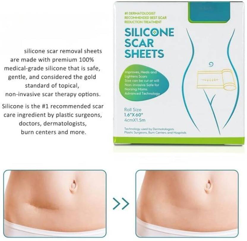 CROWNS Silicone Scar Care Tape 4cm x 150cm Gauze Medical Dressing