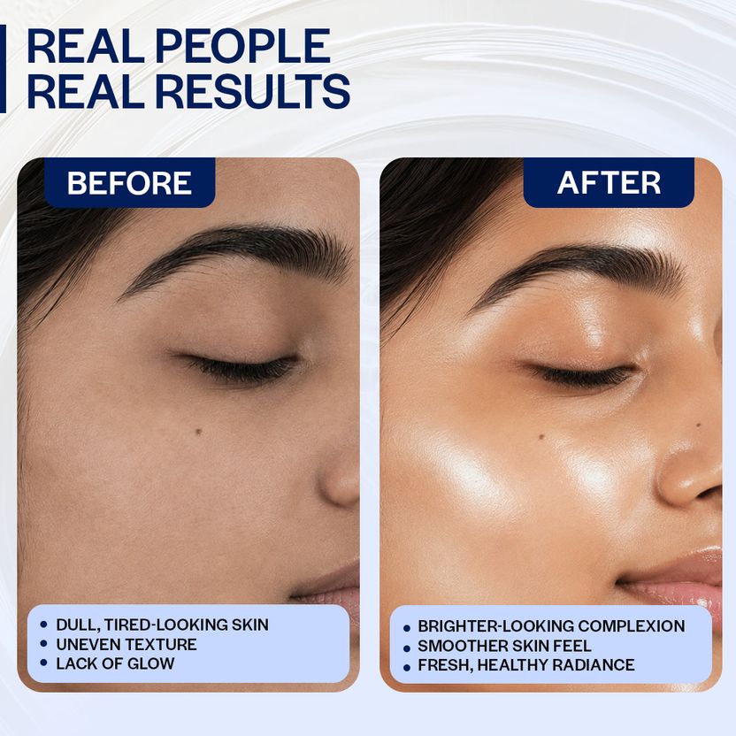 Suroskie Radiance Reveal Peel-Off Mask 75g - Image 5