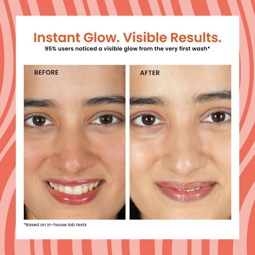 Foxtale Detan Super Glow For Tan Removal - Image 4