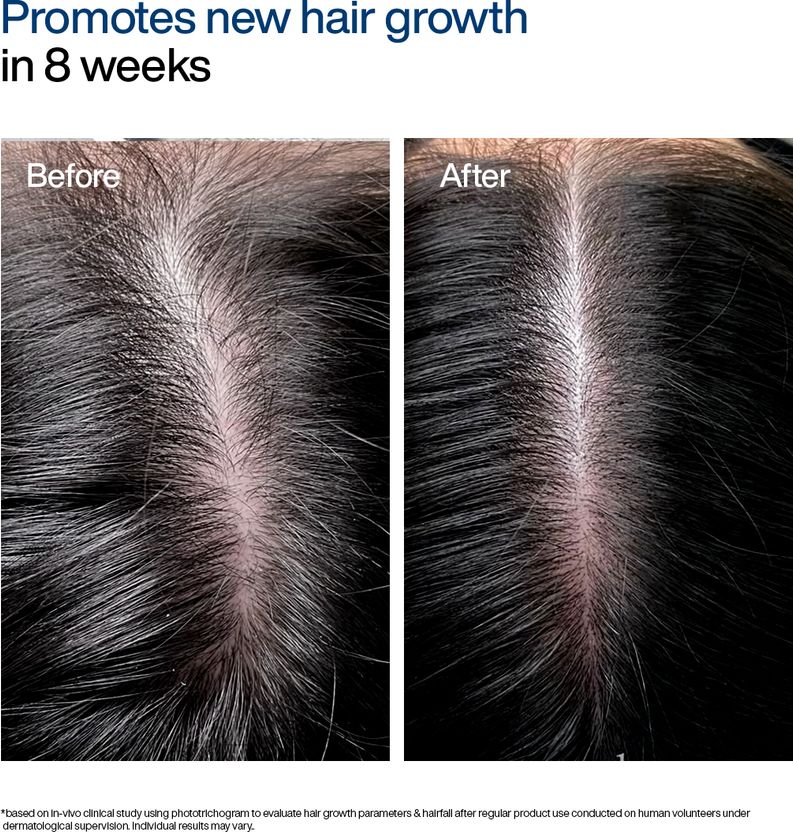 WishCare Hair Growth Serum 30ml - Image 5