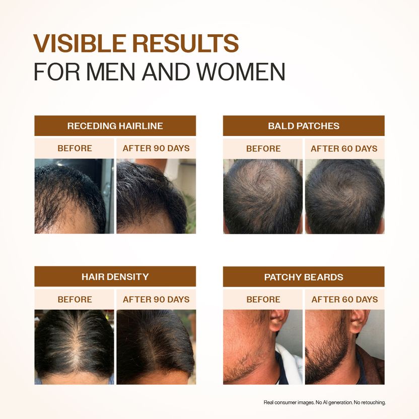 BARE Advanced Hair Growth Serum 30ml - Image 6