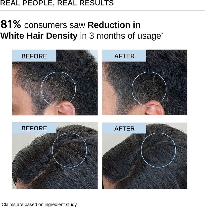 BARE Advanced Anti-Grey Hair Serum 50ml - Image 3