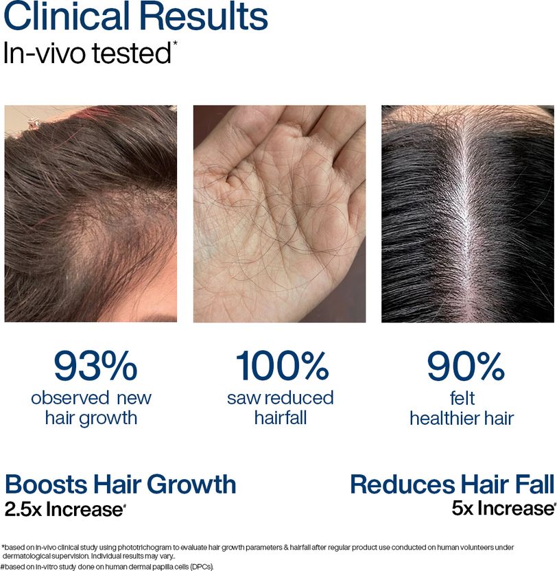 WishCare Hair Growth Serum 30ml - Image 2