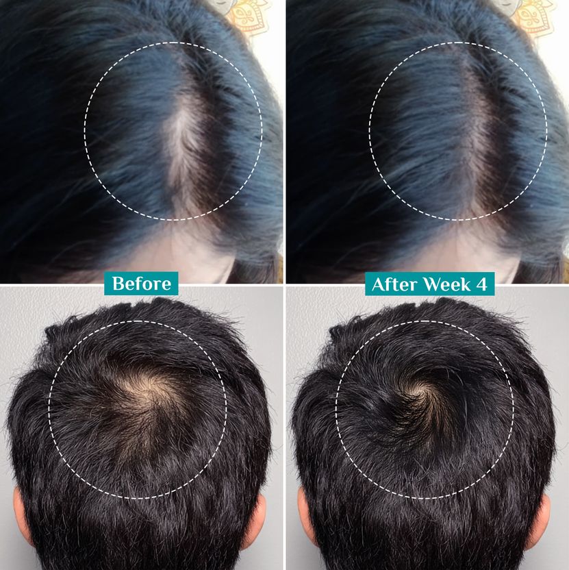 Pilgrim Advance Hair Growth Serum 30ml - Image 8