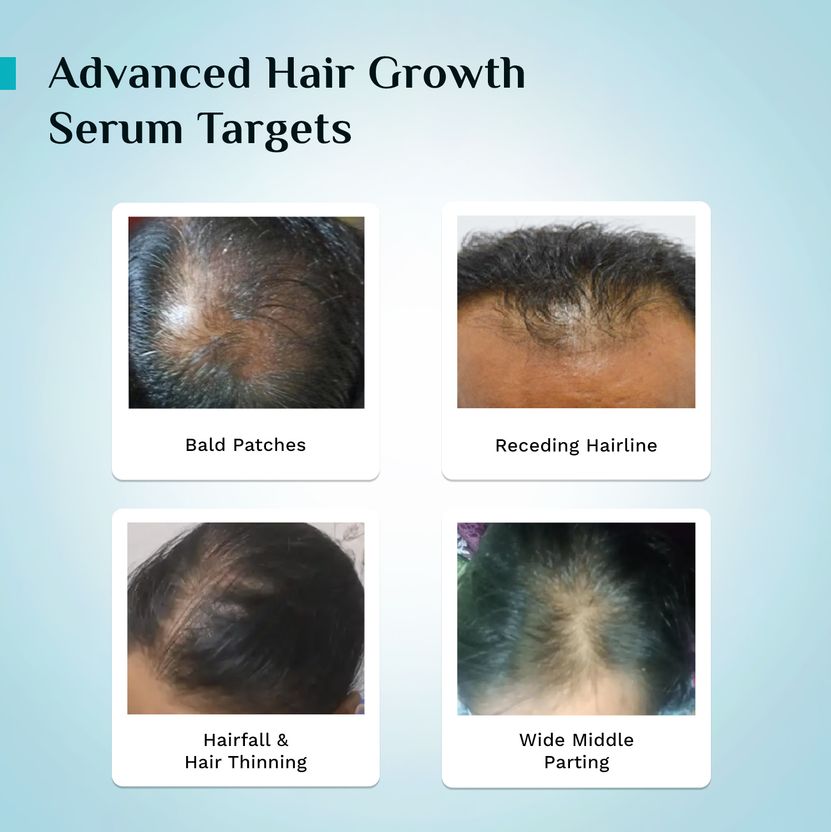 Pilgrim Advance Hair Growth Serum 30ml - Image 9