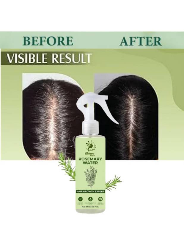 women natural Rosemary Water | Hair Growth Expert | Hair Sprey for Regrowth 659