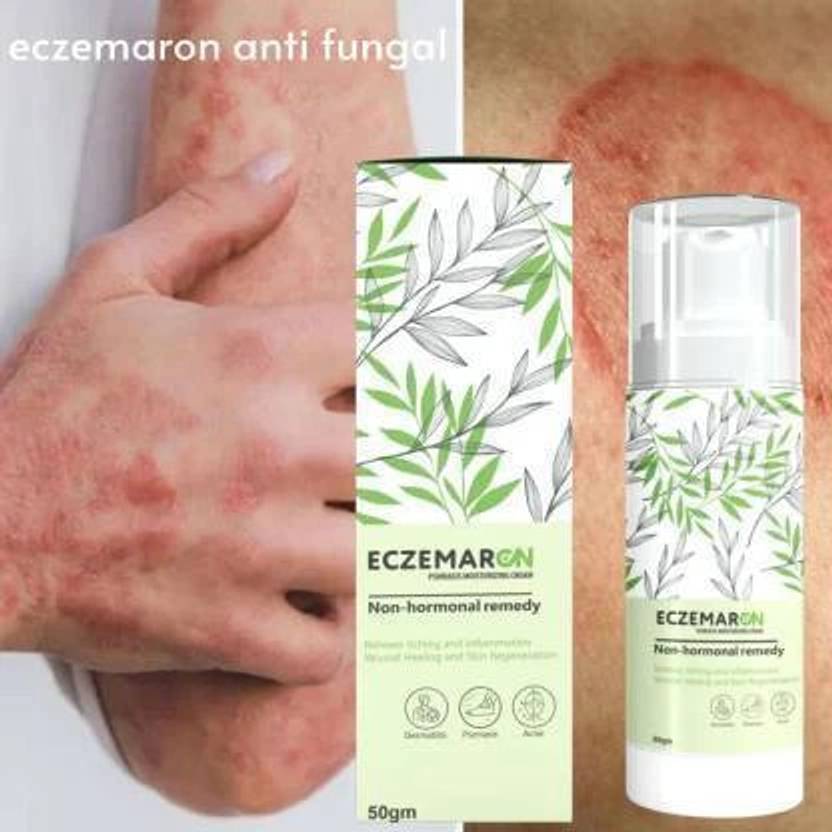 Joymart Eczemaron Anti Fungal Cream For Men & Women (50 g)