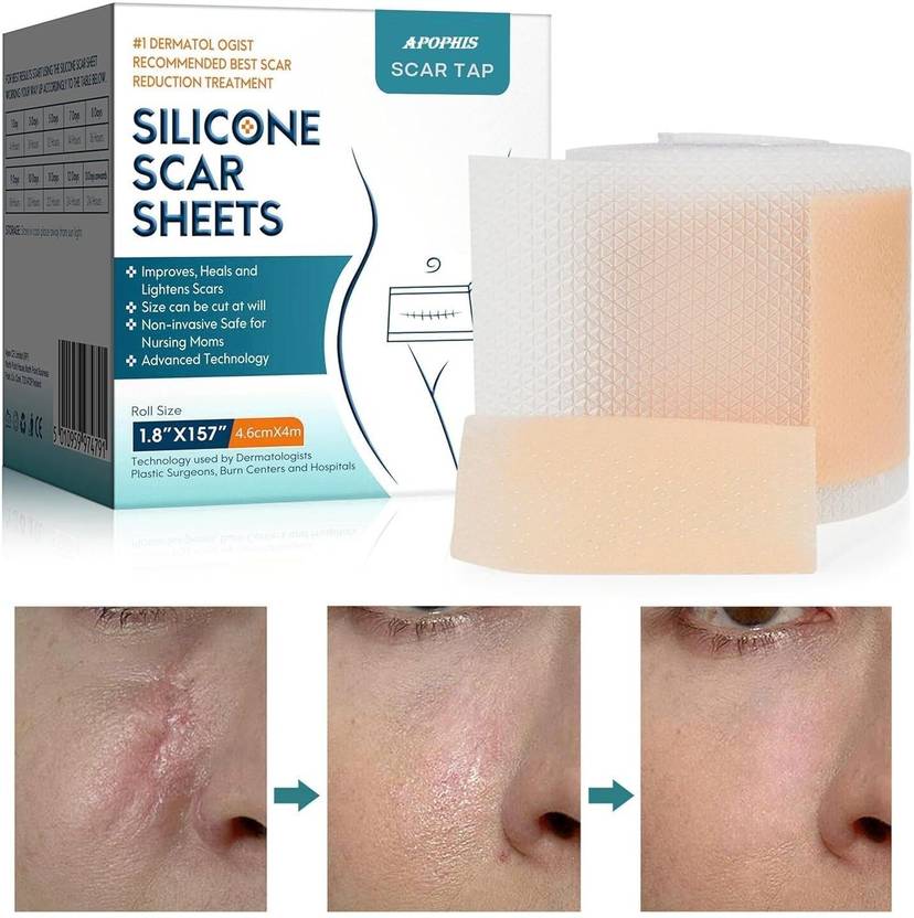 CROWNS Self Adhesive Silicone Scar Sheet 4cm x 150cm Gauze Medical Dressing