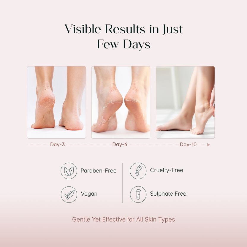 Seoulskin Glycolic Acid Foot Peeling Mask - Image 4