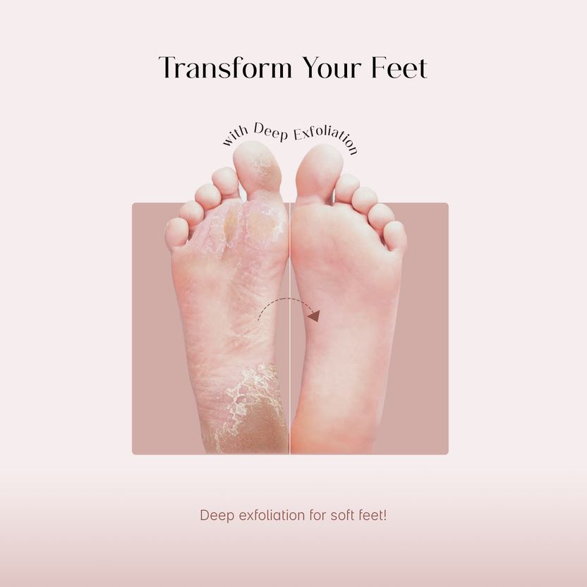 Seoulskin Glycolic Acid Foot Peeling Mask - Image 2