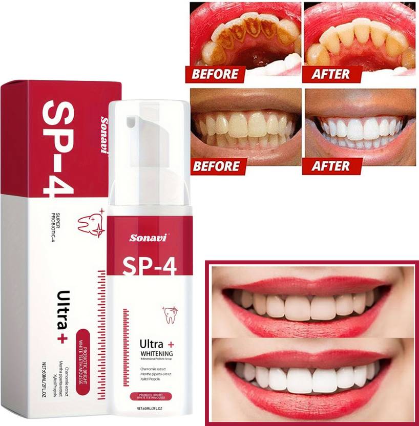 Sonavi Strong Teeth Cavity Protection Teeth Whitening Foam Teeth