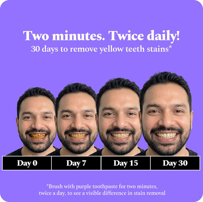 Perfora Purple Whitening Toothpaste 150g - Image 3