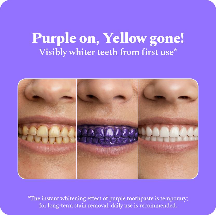 Perfora Purple Whitening Toothpaste 150g - Image 4