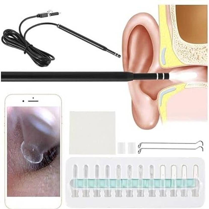 VOOCME Ear Otoscope, 3 in 1 Ear Endoscope, USB Digital Ear Camera Wax Removal Tool Android Phone