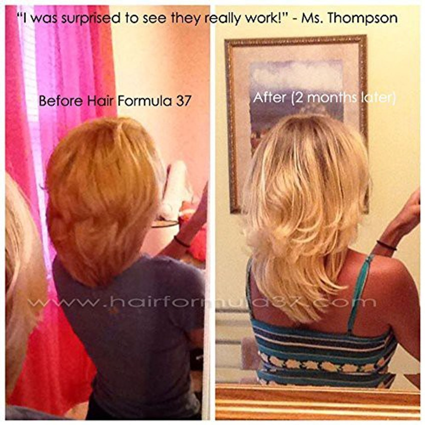 IN... - Hair Formula 37 Hair Vitamins For Fast Hair Growth | Facebook