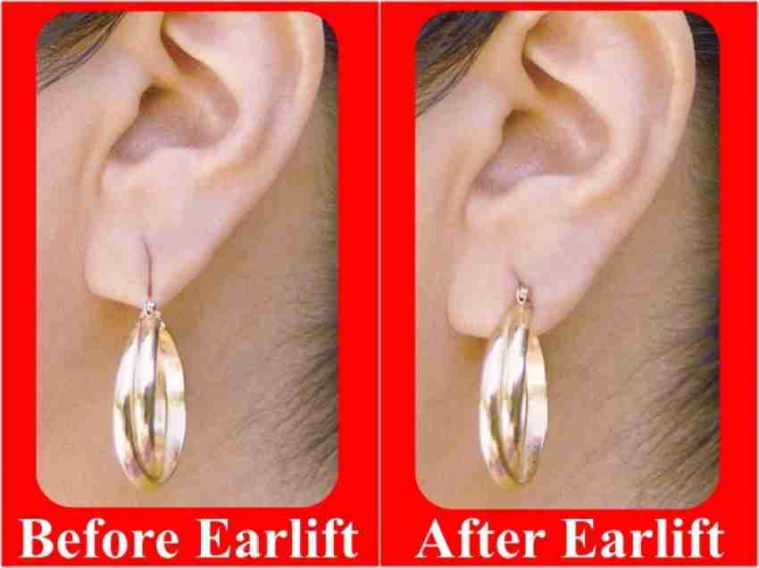 Medical Grade Invisible Women Relieve Strain From Heavy Earrings Ear Lobe  Support Tape Ear Saver Ear Care Ear Lift