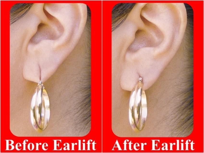 Buy LOBE MIRACLE Ear Lobe Support Patches, ear lobe support for earrings,  Protects Healthy Ear Lobes from Tearing Designed to Support and Lift the  Earlobe Pack of 30 Online at Best Prices