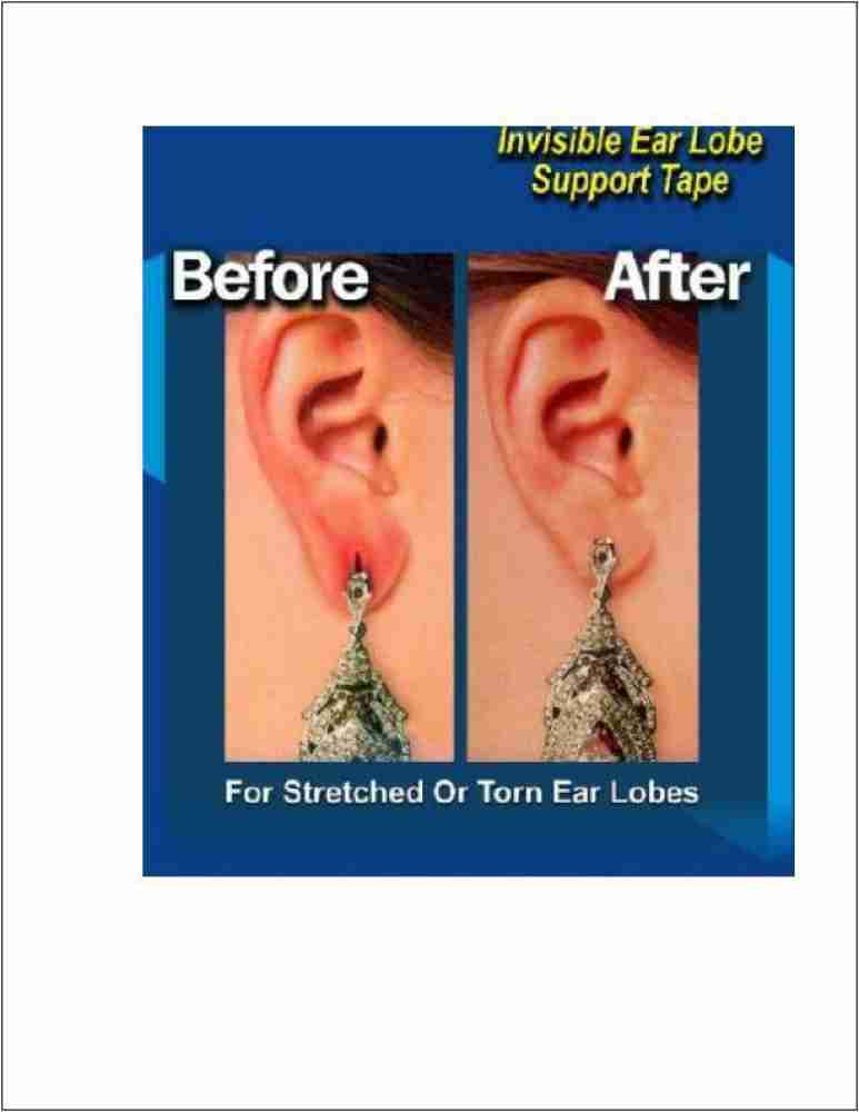 LOBE MIRACLE Disposable Ear Lobe Support Price in India - Buy LOBE MIRACLE  Disposable Ear Lobe Support online at
