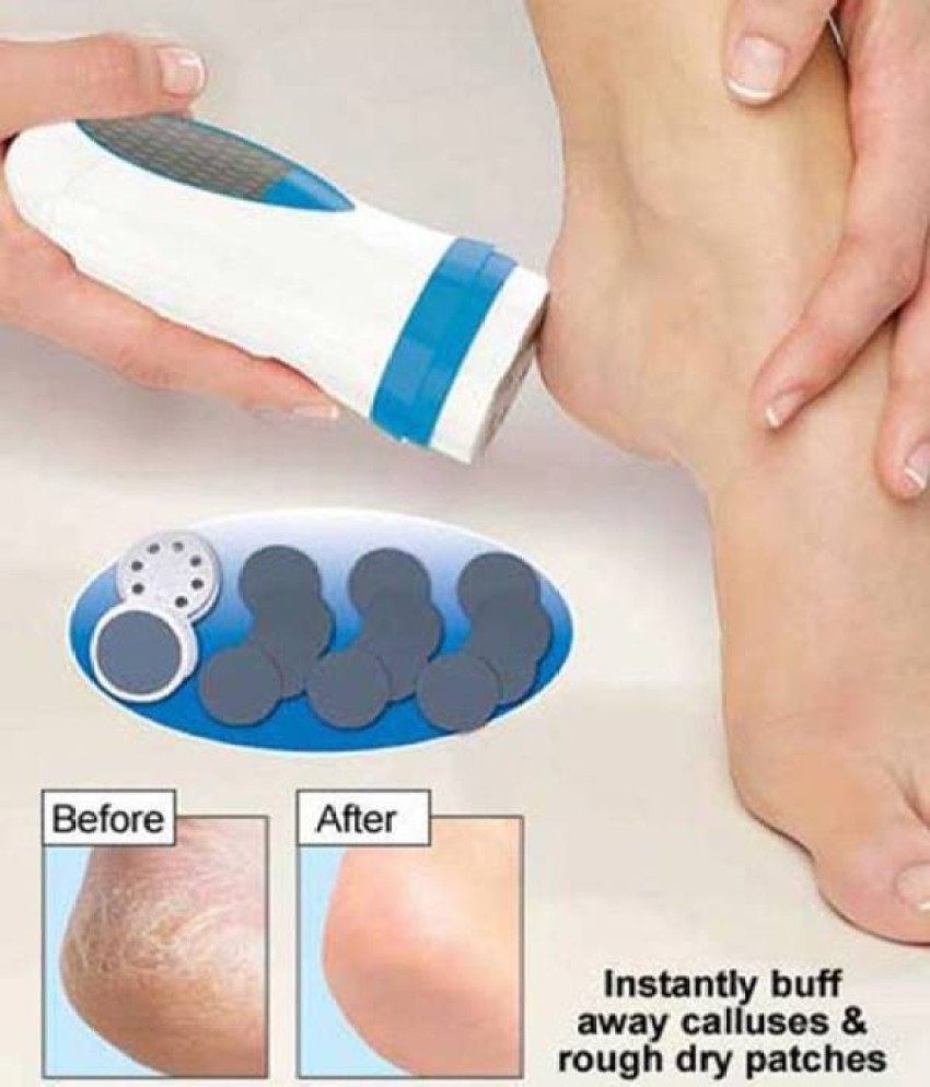 https://rukminim2.flixcart.com/image/850/1000/j83d8cw0/foot-filer/9/c/r/foot-smoothing-personal-pedi-spin-callus-remover-bluebells-india-original-imaey3pmnevzx8u6.jpeg?q=90