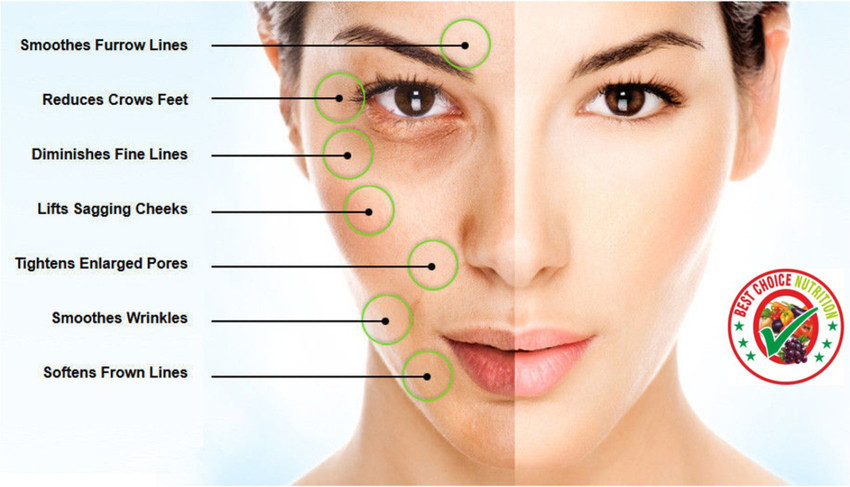 Vitamin e sales oil acne