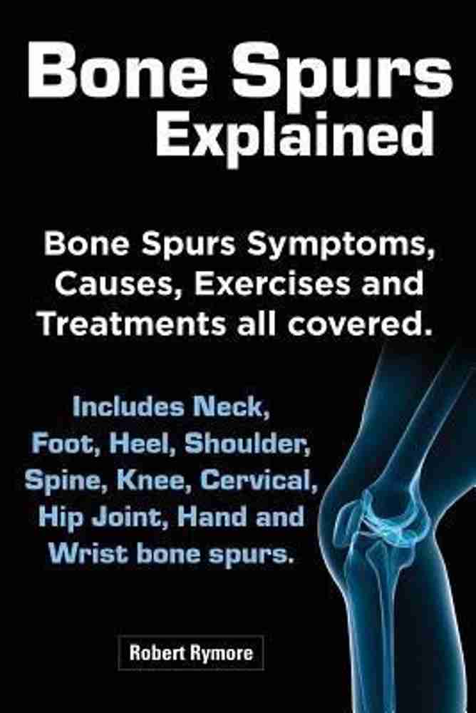 Bone Spurs Explained. Bone Spurs Symptoms Causes Exercises and
