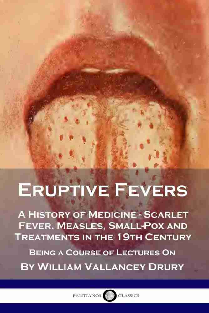 Scarlet Fever: A Deadly History and How it Prevails