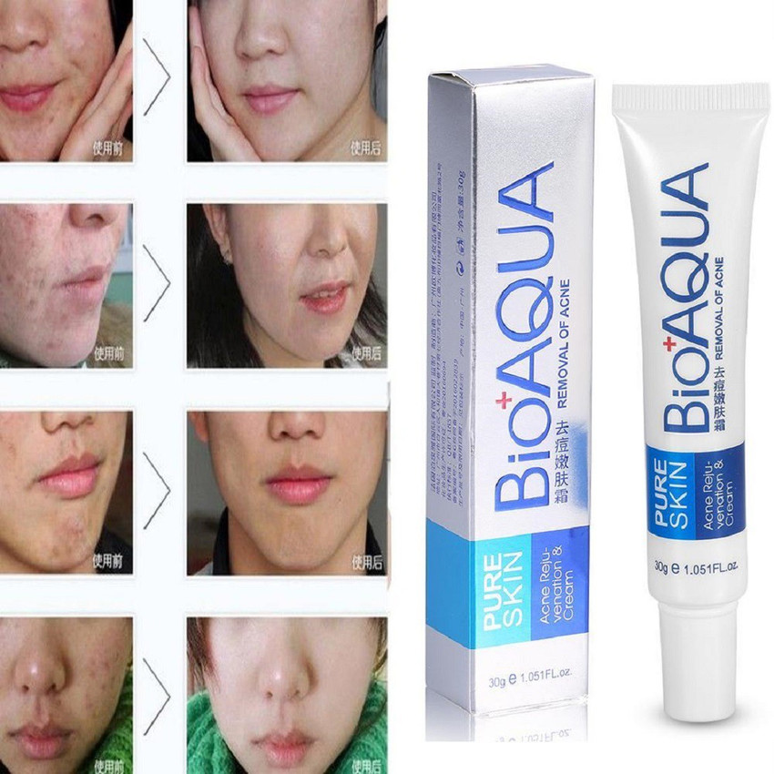 Best cream to remove pimple deals marks