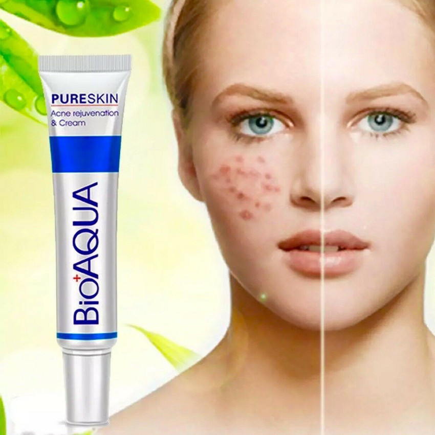 Pimple skin hot sale cream
