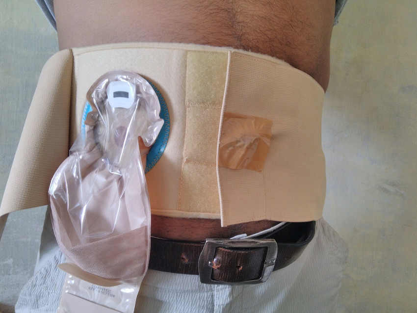 Colostomy Bag Belt