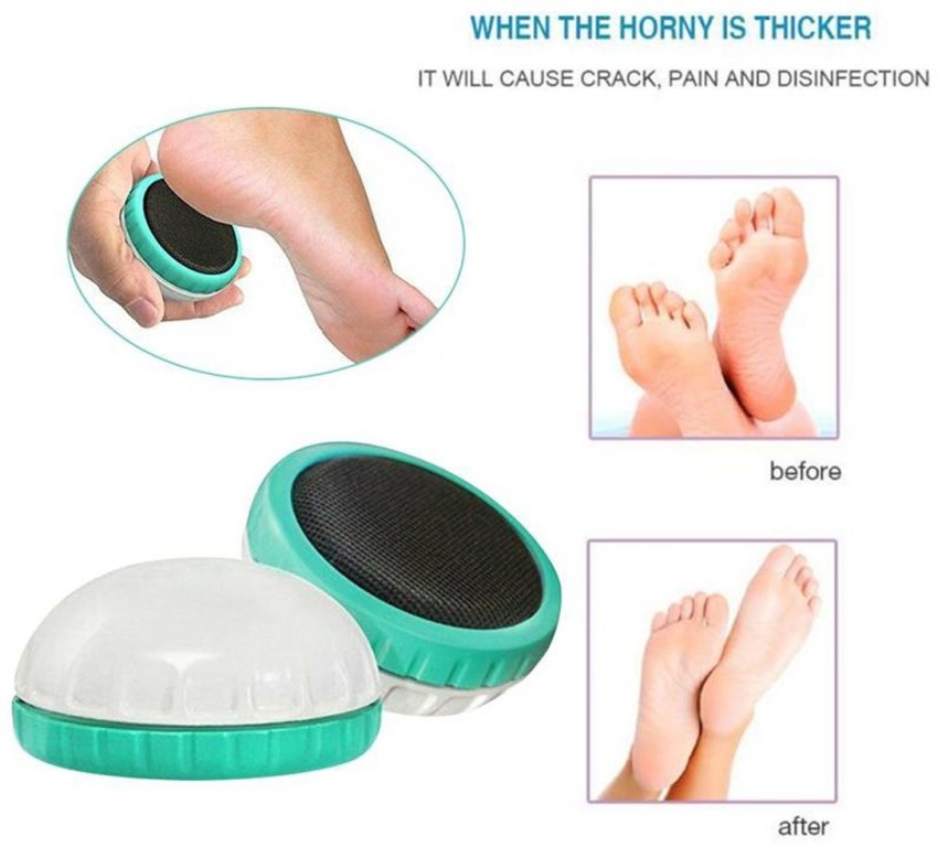 Skoother Skin Smoother Foot File and Callus Remover