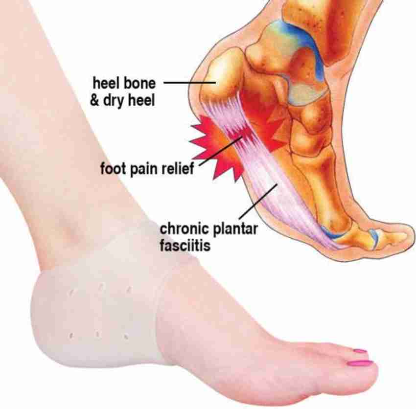 Dry best sale heel pain