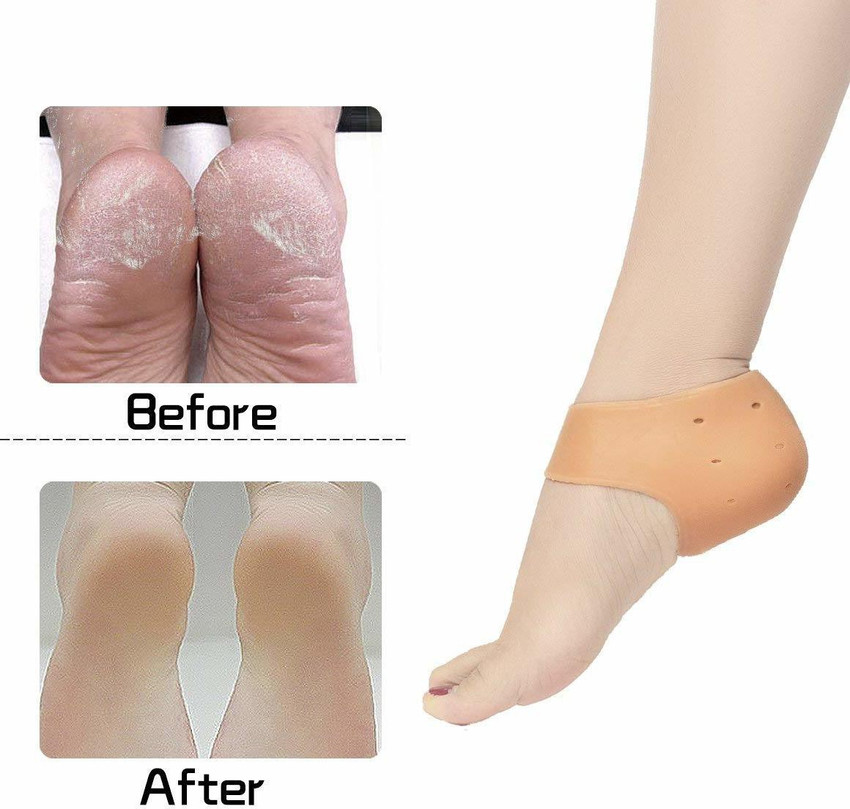 Best treatment for 2024 plantar fasciitis 219