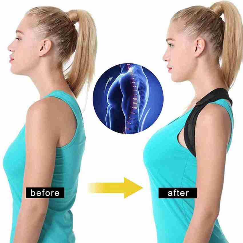 Best posture corrector for neck hump cheap
