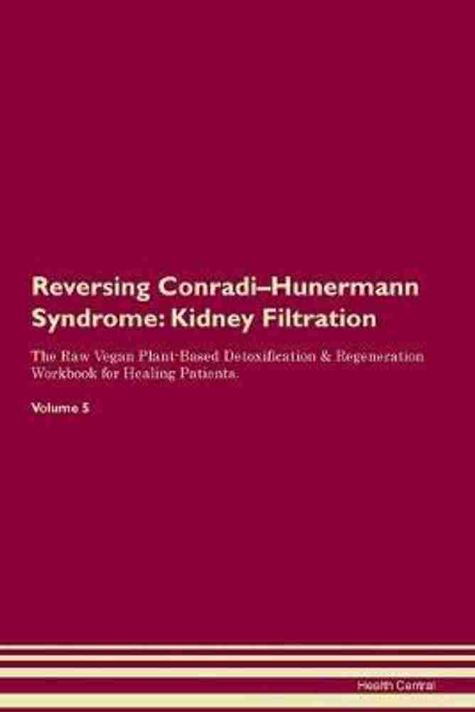 Conradi Hunermann Syndrome
