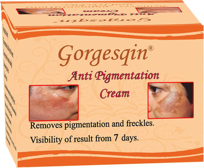 Anti pigmentation cream cheap