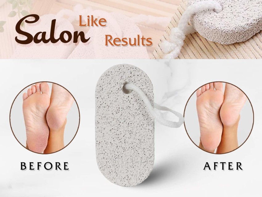 Natural Pumice Stone for Feet 2 PCS, Lava Pedicure Tools Hard Skin Callus  Remover for Feet and Hands - Natural Foot File Exfoliat