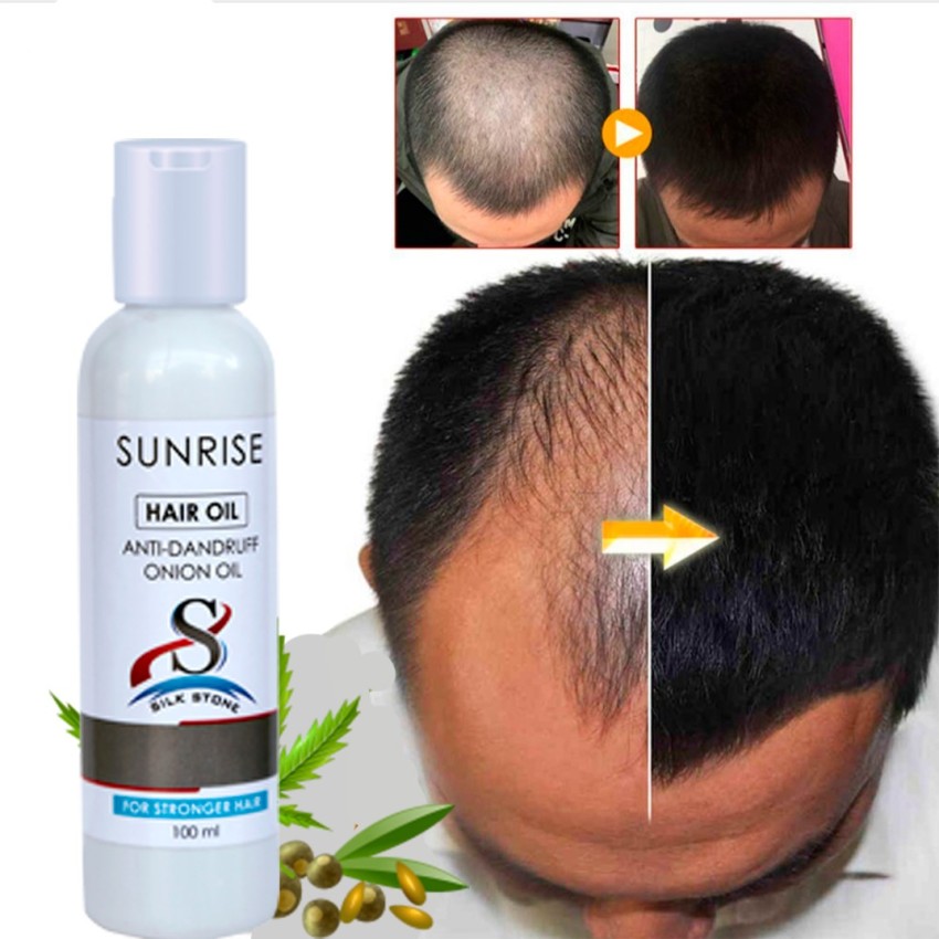 Men's Sunrise Oil