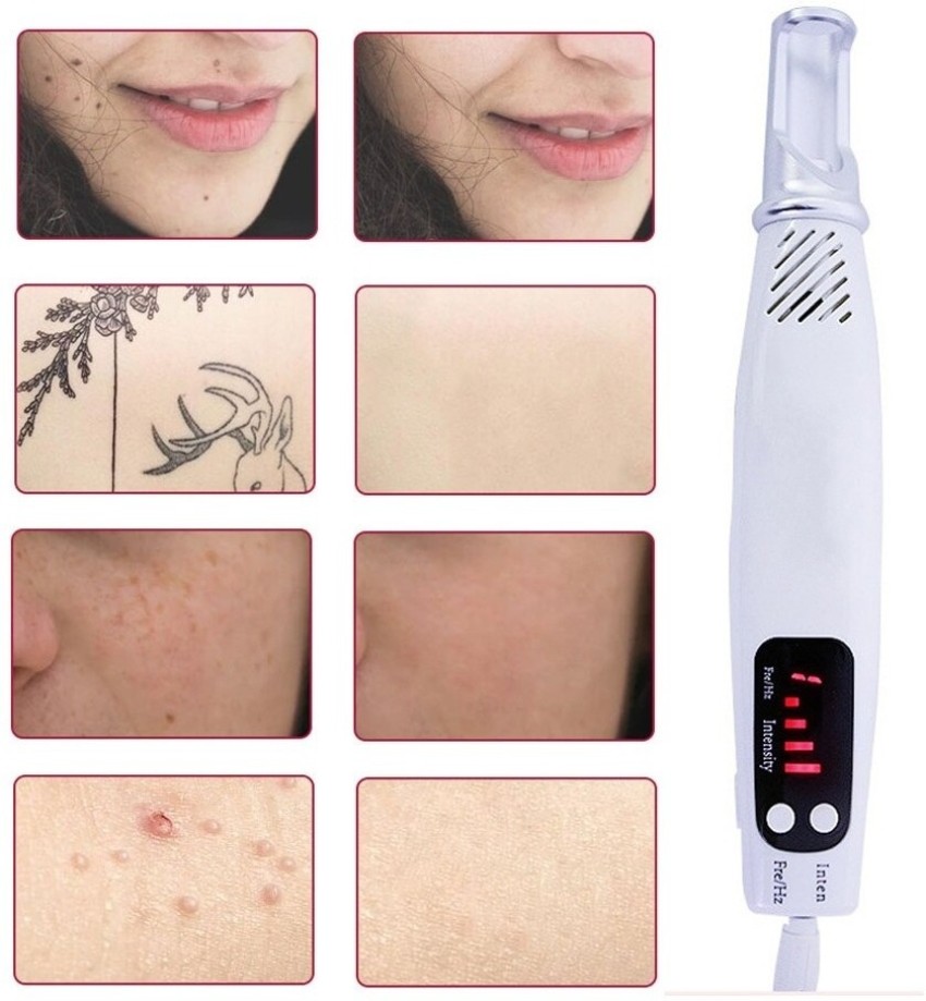 Professional Tattoo Removal Laser Picosecond Pen  Trabyhand
